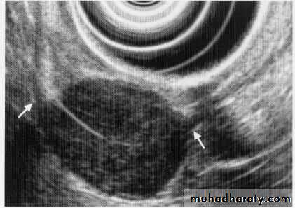 Endoscopic GIT