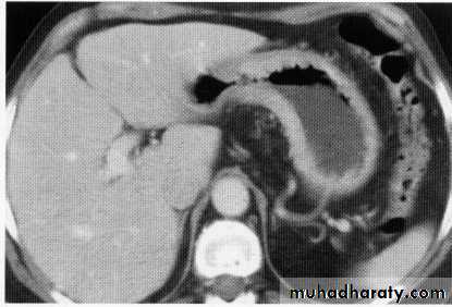 Endoscopic GIT