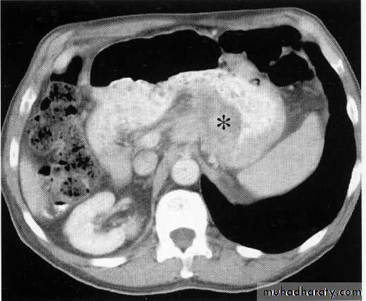 Endoscopic GIT