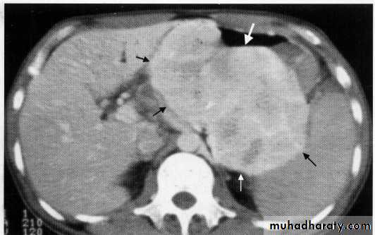 Endoscopic GIT