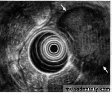 Endoscopic GIT