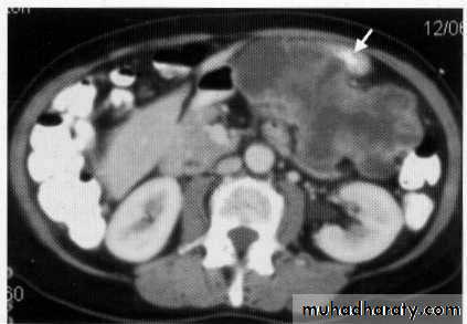 Endoscopic GIT