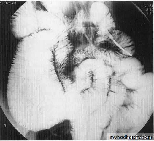 Endoscopic GIT