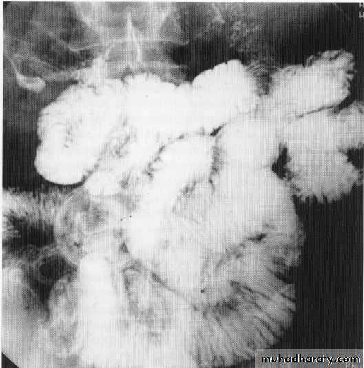 Endoscopic GIT