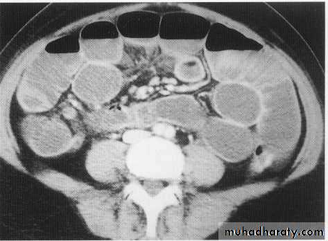 Endoscopic GIT