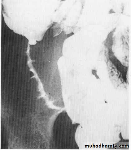 Endoscopic GIT