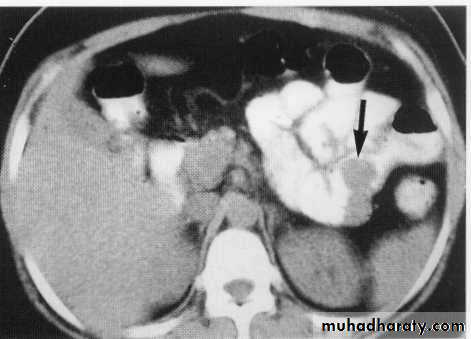Endoscopic GIT