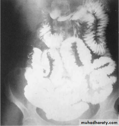 Endoscopic GIT