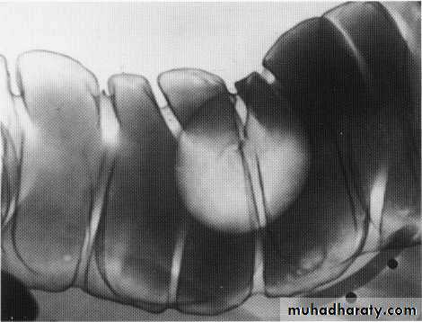 Endoscopic GIT