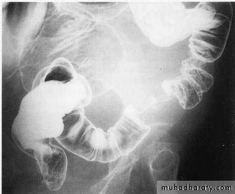 Endoscopic GIT