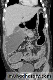 Endoscopic GIT