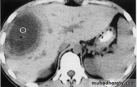 Endoscopic GIT