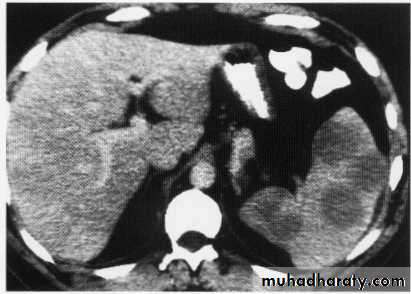 Endoscopic GIT