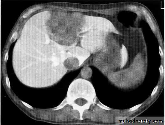 Endoscopic GIT