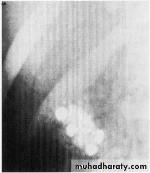 Endoscopic GIT