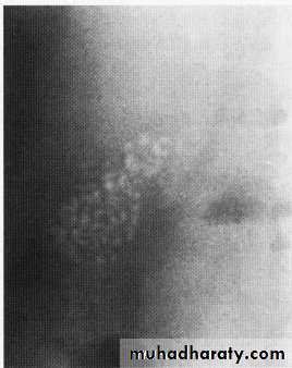 Endoscopic GIT