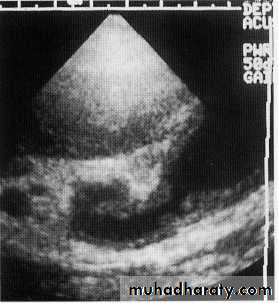 Endoscopic GIT