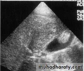 Endoscopic GIT