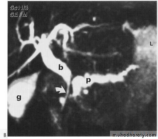 Endoscopic GIT