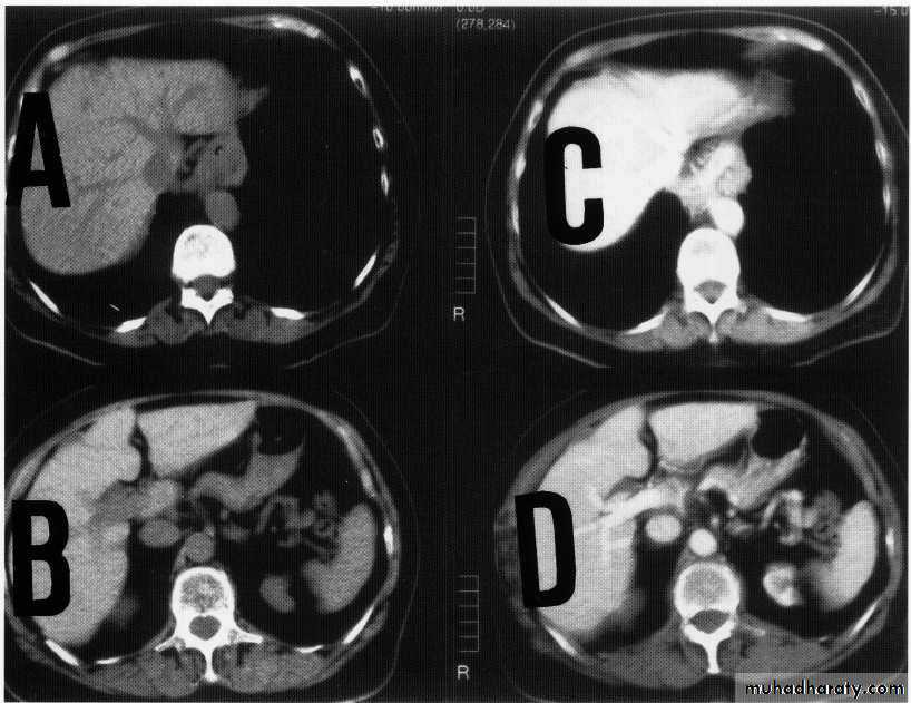 Endoscopic GIT