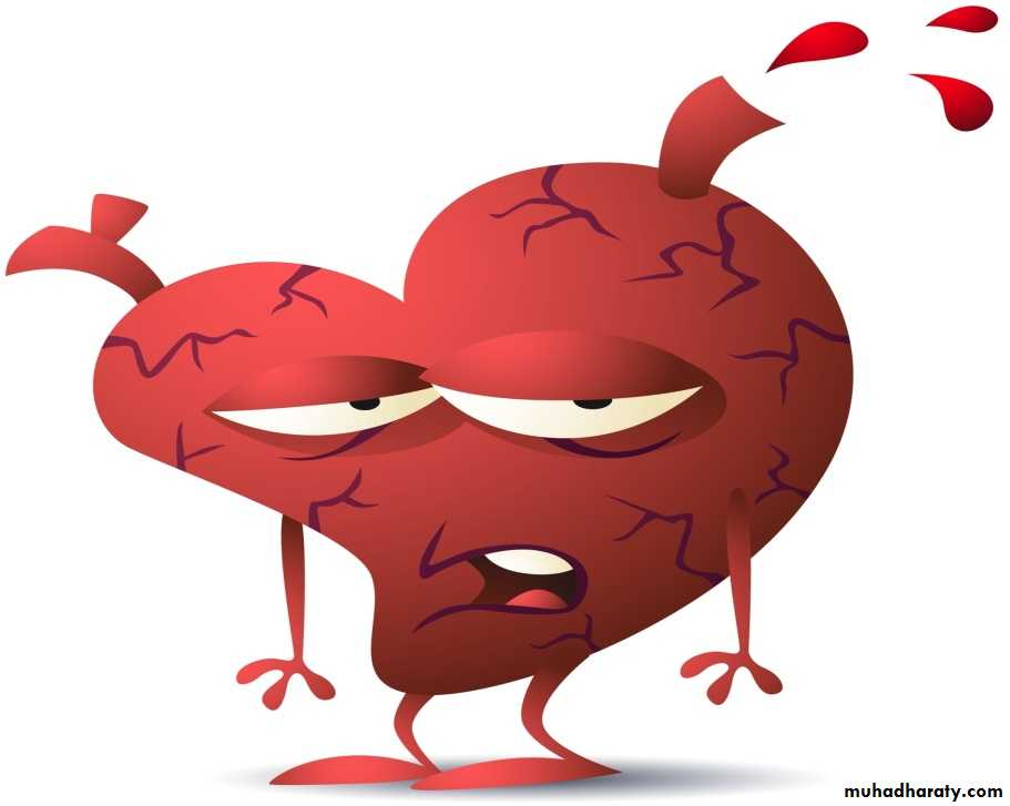 Heart failure 1