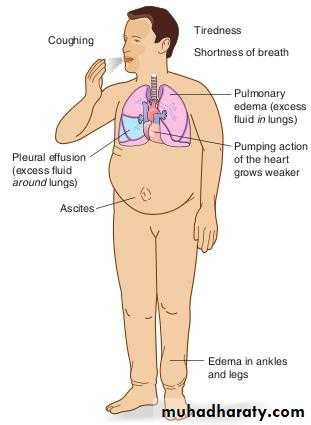 Heart failure 1