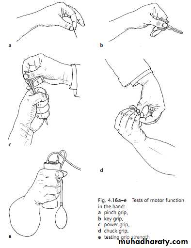 Upper limbs orthopedic
