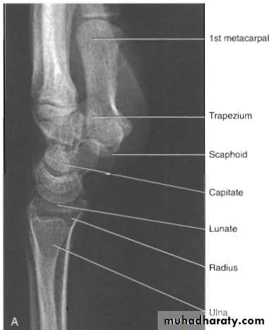 Upper limbs orthopedic
