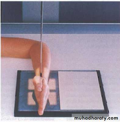 Upper limbs orthopedic