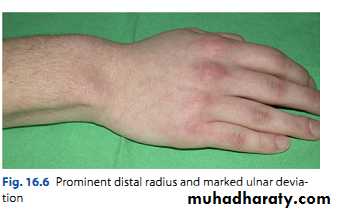 Upper limbs orthopedic