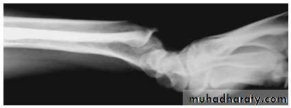 Upper limbs orthopedic