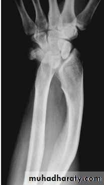 Upper limbs orthopedic