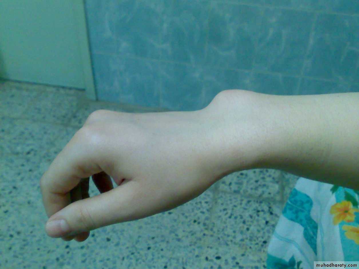 Upper limbs orthopedic