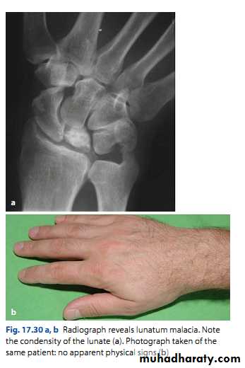 Upper limbs orthopedic