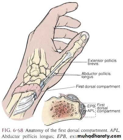 Upper limbs orthopedic