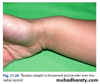 Upper limbs orthopedic