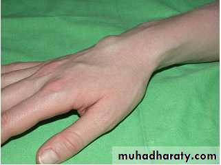 Upper limbs orthopedic