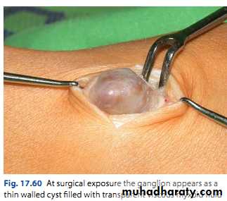 Upper limbs orthopedic