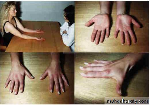 Upper limbs orthopedic