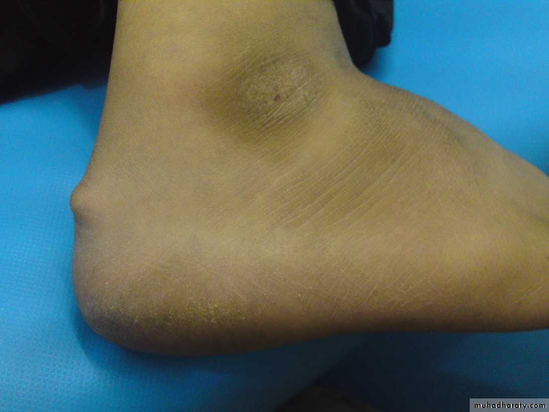 Upper limbs orthopedic