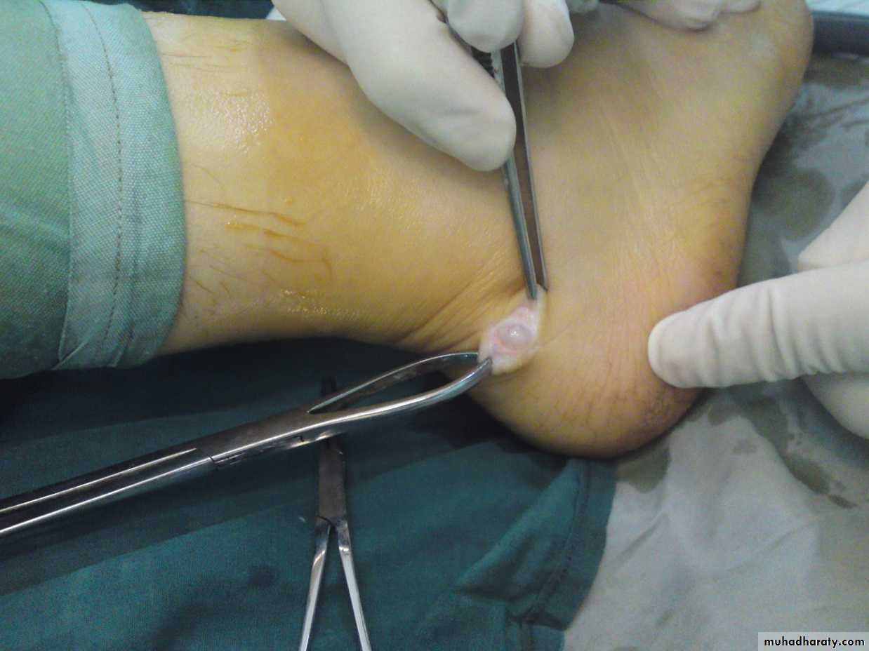 Upper limbs orthopedic