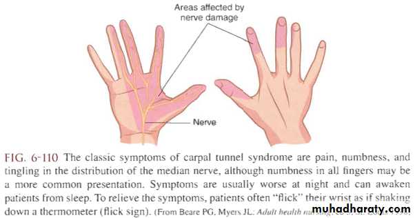 Upper limbs orthopedic