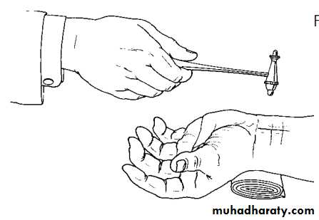 Upper limbs orthopedic