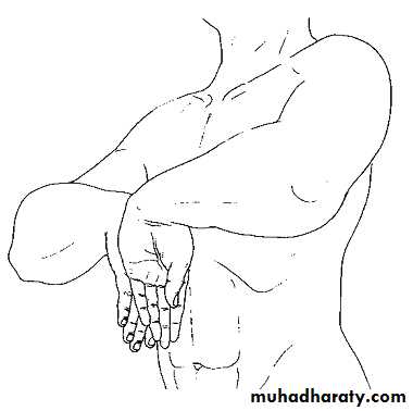 Upper limbs orthopedic