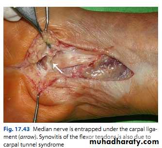 Upper limbs orthopedic