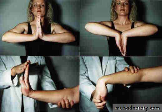 Upper limbs orthopedic