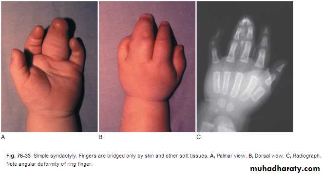 Upper limbs orthopedic