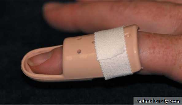 Upper limbs orthopedic