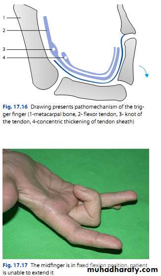 Upper limbs orthopedic