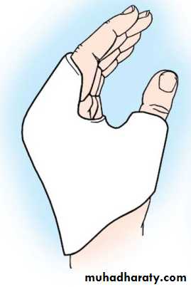 Upper limbs orthopedic